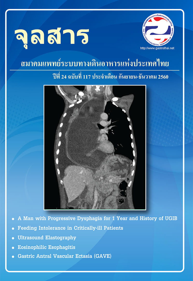 จุลสารสมาคมแพทย์ระบบทางเดินอาหารแห่งประเทศไทย ปีที่ 24 ฉบับที่ 117