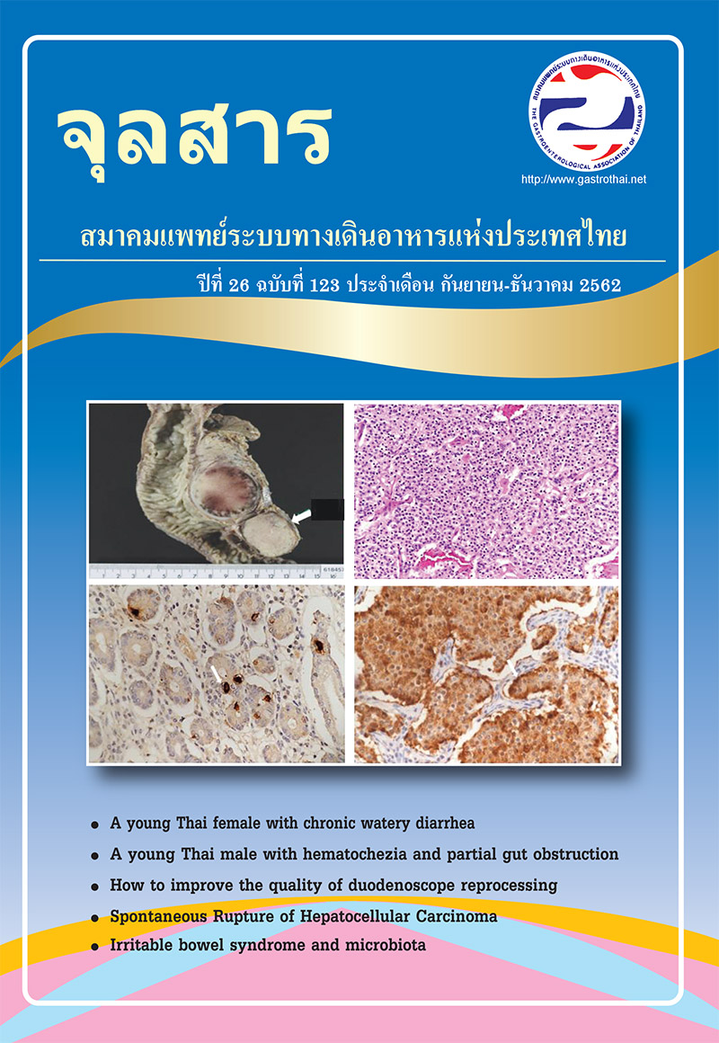 จุลสารสมาคมแพทย์ระบบทางเดินอาหารแห่งประเทศไทย ปีที่ 26 ฉบับที่ 123