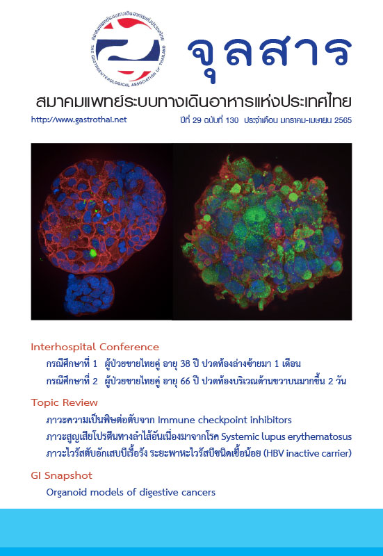 จุลสารสมาคมแพทย์ระบบทางเดินอาหารแห่งประเทศไทย ปีที่ 29 ฉบับที่ 130
