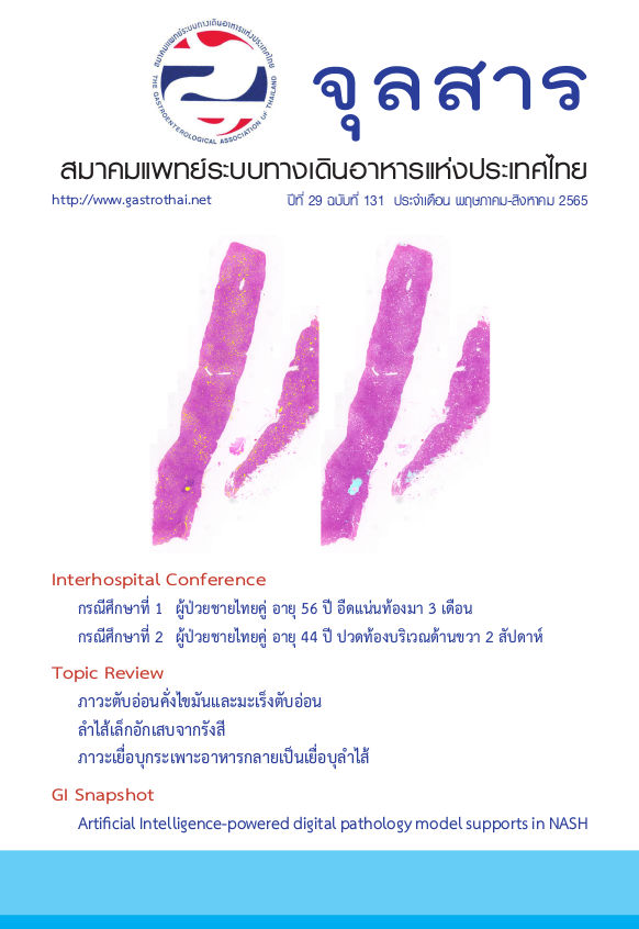 จุลสารสมาคมแพทย์ระบบทางเดินอาหารแห่งประเทศไทย ปีที่ 29 ฉบับที่ 131 พฤษภาคม - สิงหาคม 2565