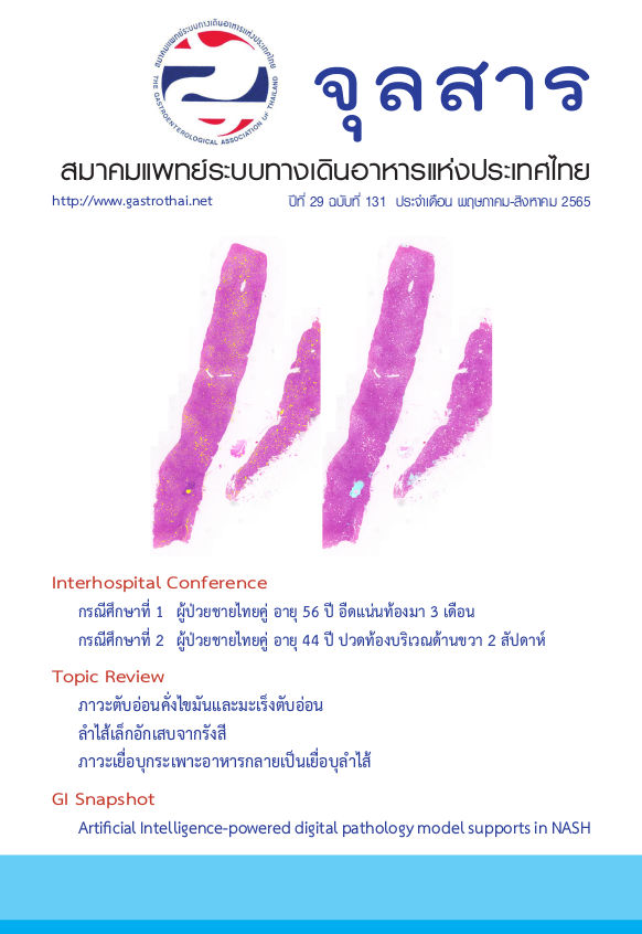 จุลสารสมาคมแพทย์ระบบทางเดินอาหารแห่งประเทศไทย ปีที่ 29 ฉบับที่ 131