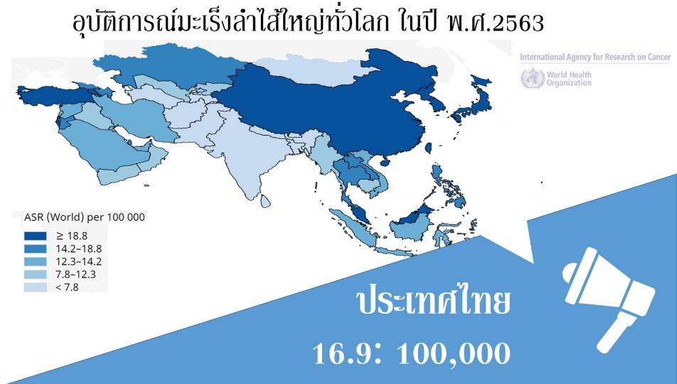 ข้อควรรู้เกี่ยวกับมะเร็งลำไส้ใหญ่