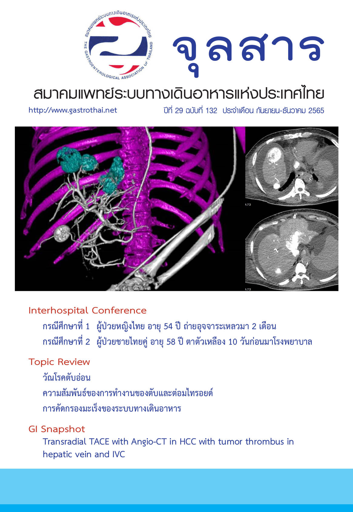 จุลสารสมาคมแพทย์ระบบทางเดินอาหารแห่งประเทศไทย ปีที่ 29 ฉบับที่ 132