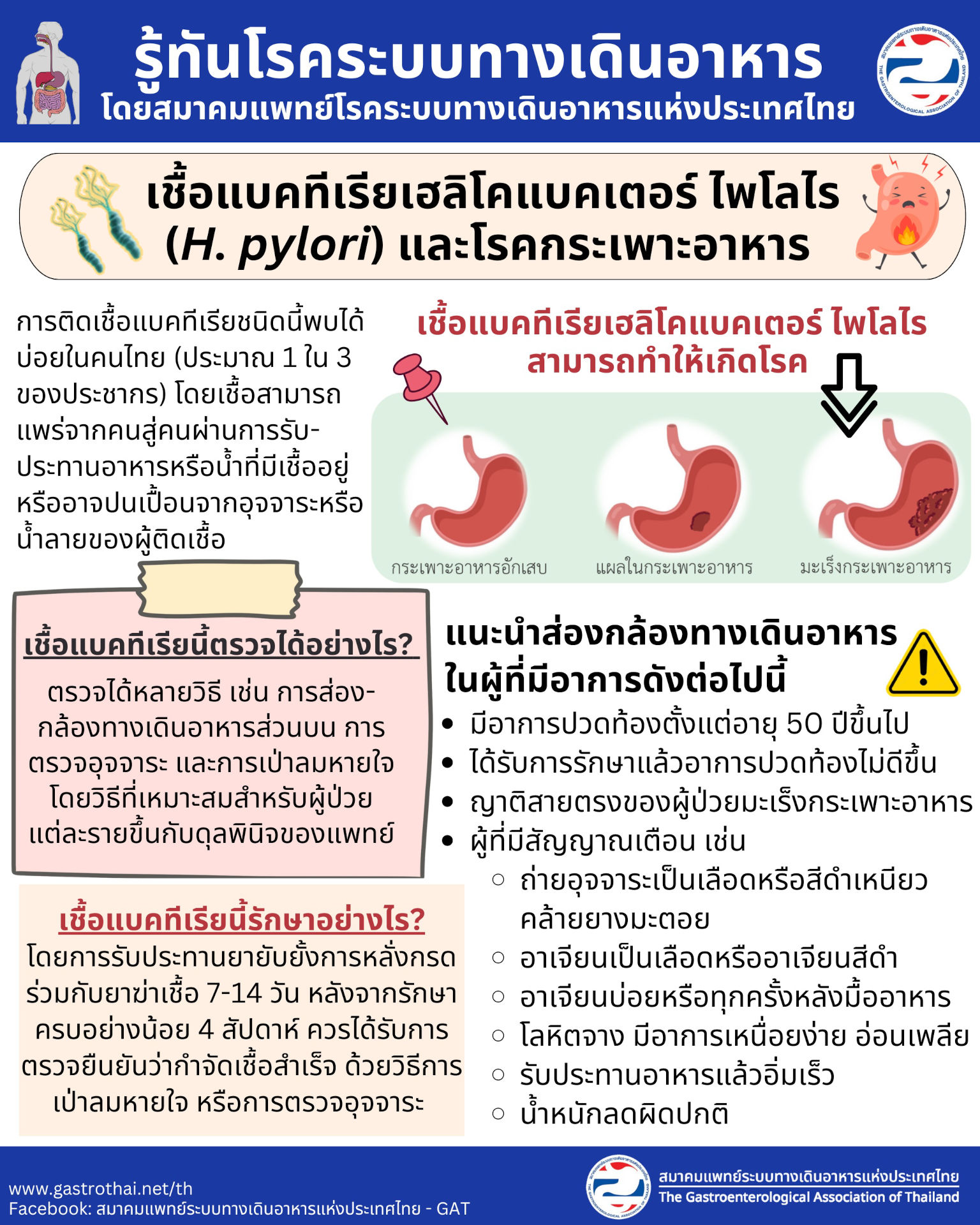 เชื้อแบคทีเรียเฮลิโคแบคเตอร์ ไพโลไร (H. pylori) และโรคกระเพาะอาหาร